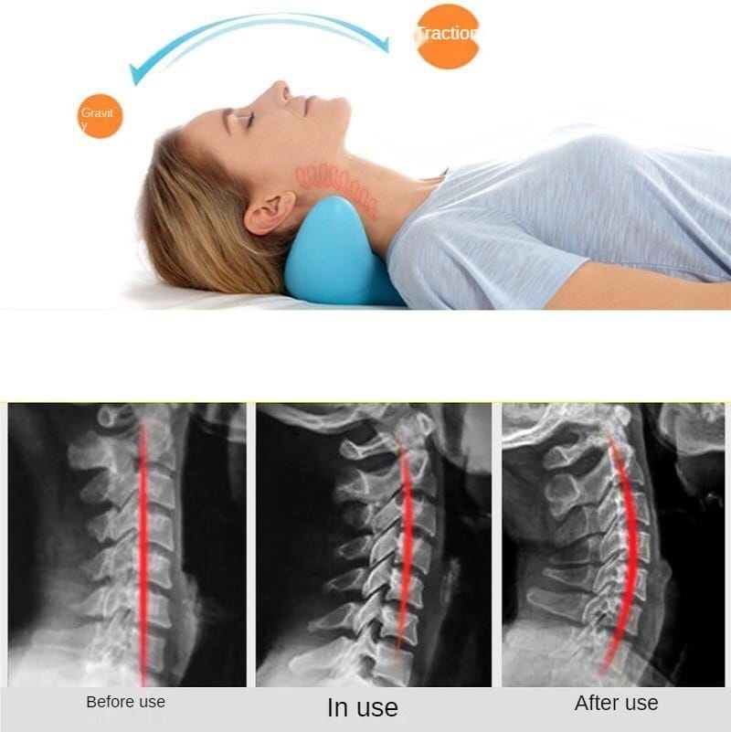 c1593db5-ebdd-40e3-84fb-fbb4644faf38.jpg Cervical Spine Massage Pillow Gravity Acupressure Neck Massager Cervical Spine Pillow Neck Shoulder Massage Pillow Home Traction Corrector - Image 4